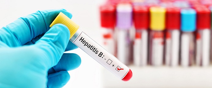 hepatit-gunu-1